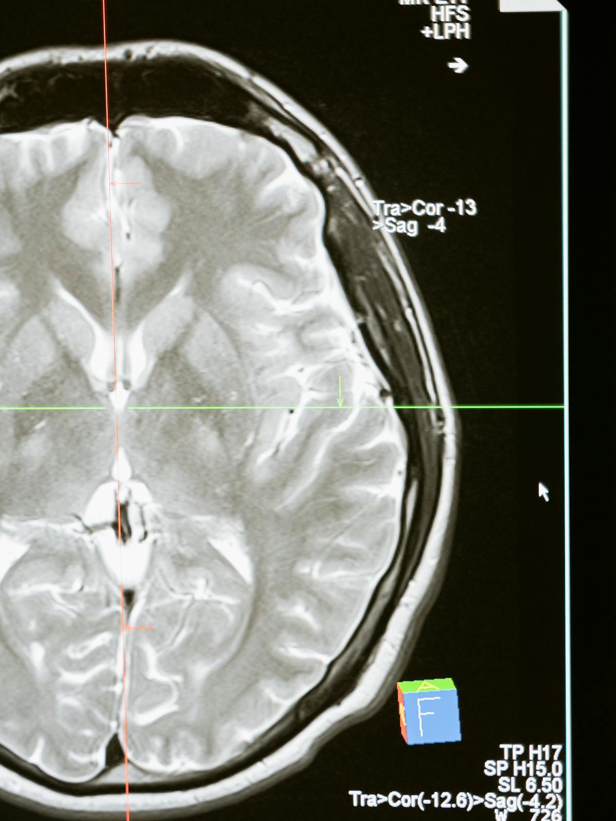 Cuaderno de registro usado para anotar sintomas y seguimiento.