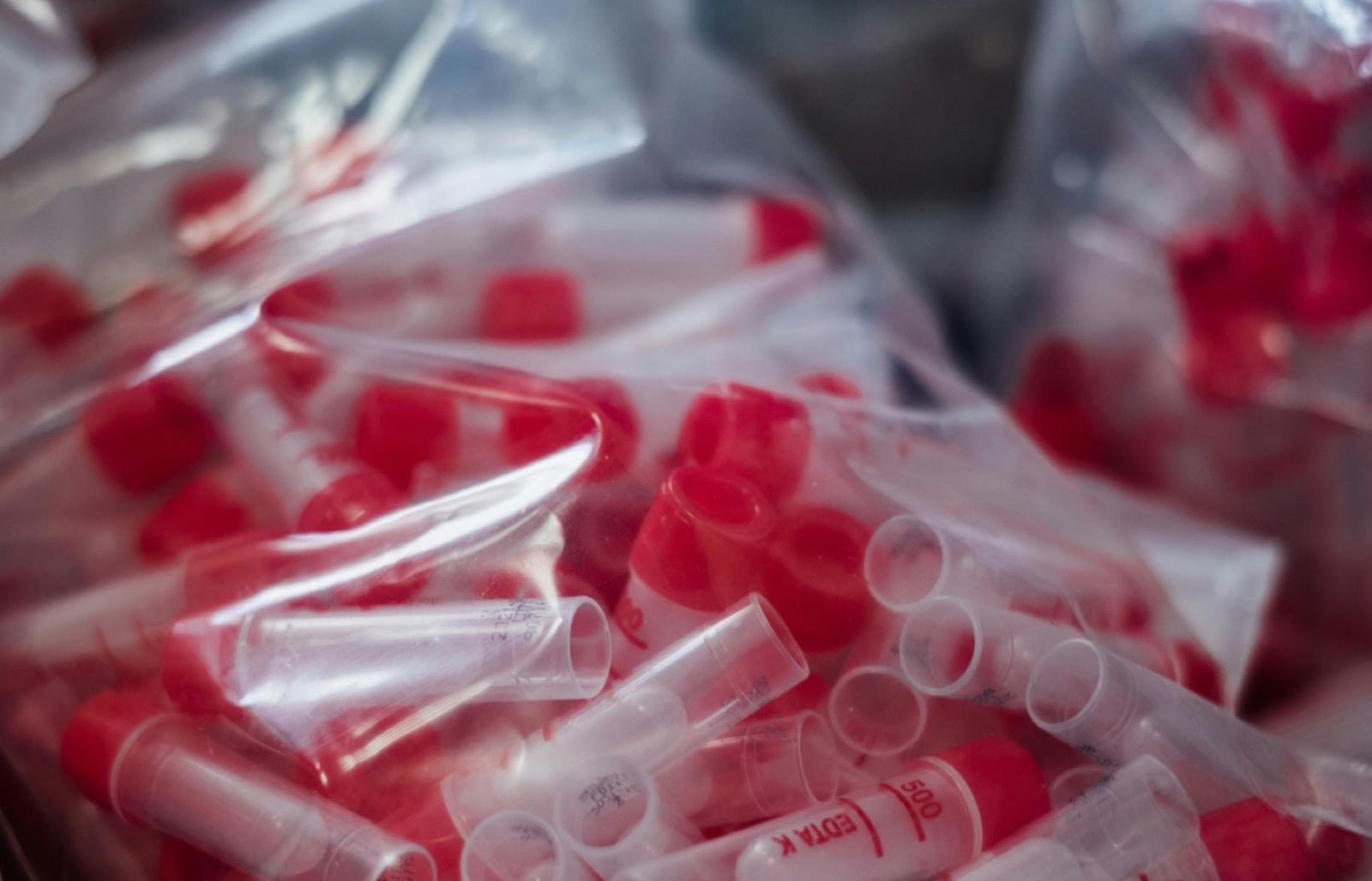 Mujer en reposo durante un episodio de dolor con impacto funcional.