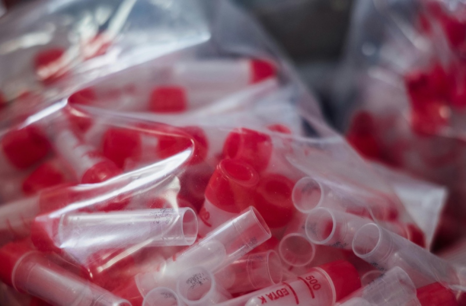 Paciente en cama durante un episodio de dolor que limita actividades.