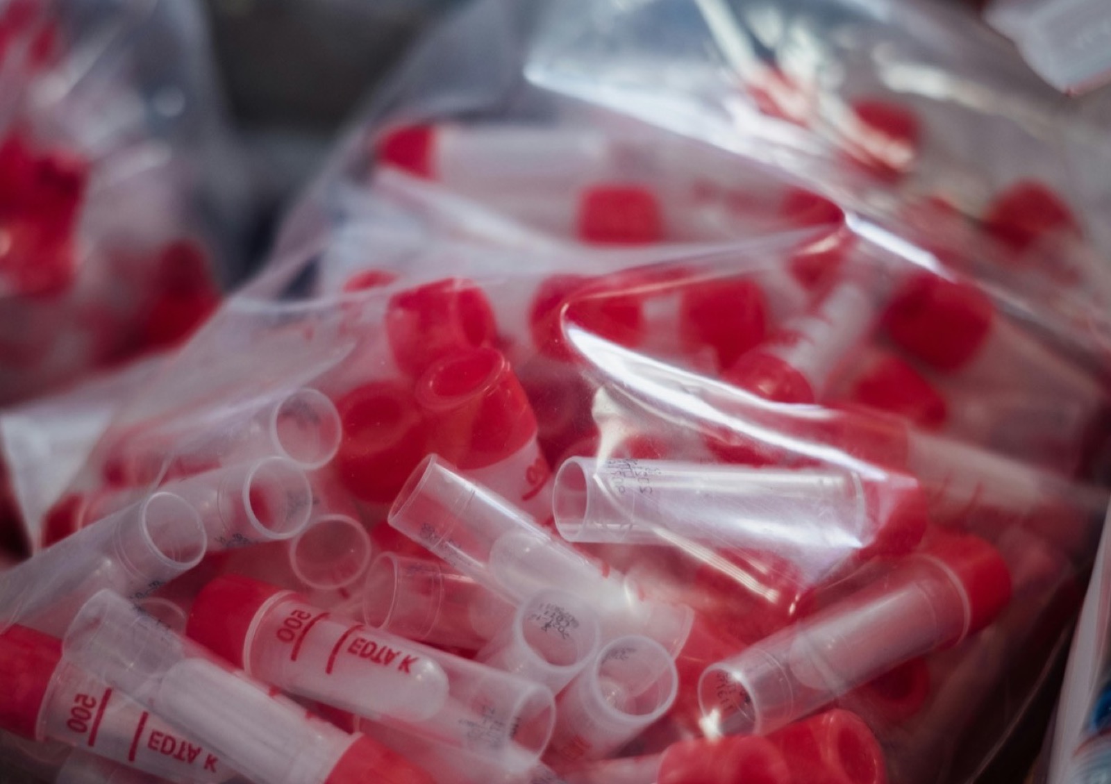 Mujer recostada durante una crisis de dolor con repercusion funcional.